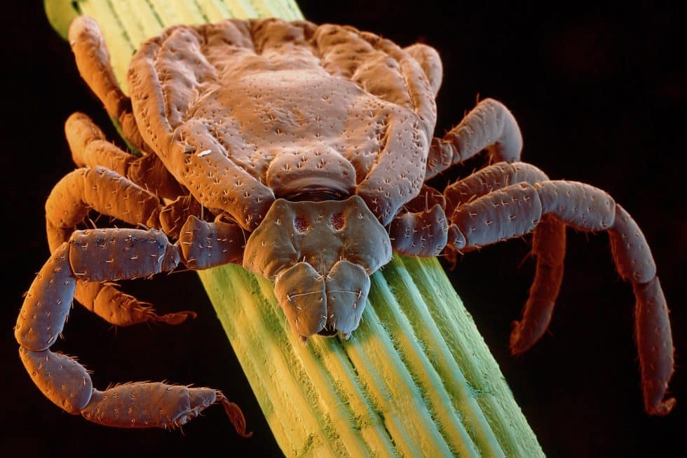 Warming Planet Ups Risk of Deadly Tick-Borne Fever