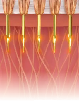 Grande plano de um dispositivo avançado de tratamento da pele com laser que visa as camadas da pele.
