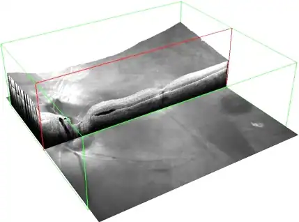 3D visualization of retina imaging showing detailed retinal layers and structures in grayscale.