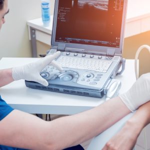 stem cell trials