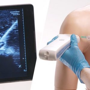 successful stem cell treatments