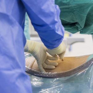 stem cell diseases