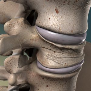 stem cell for knees