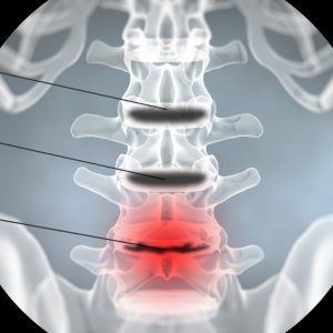 regenerative medicine
