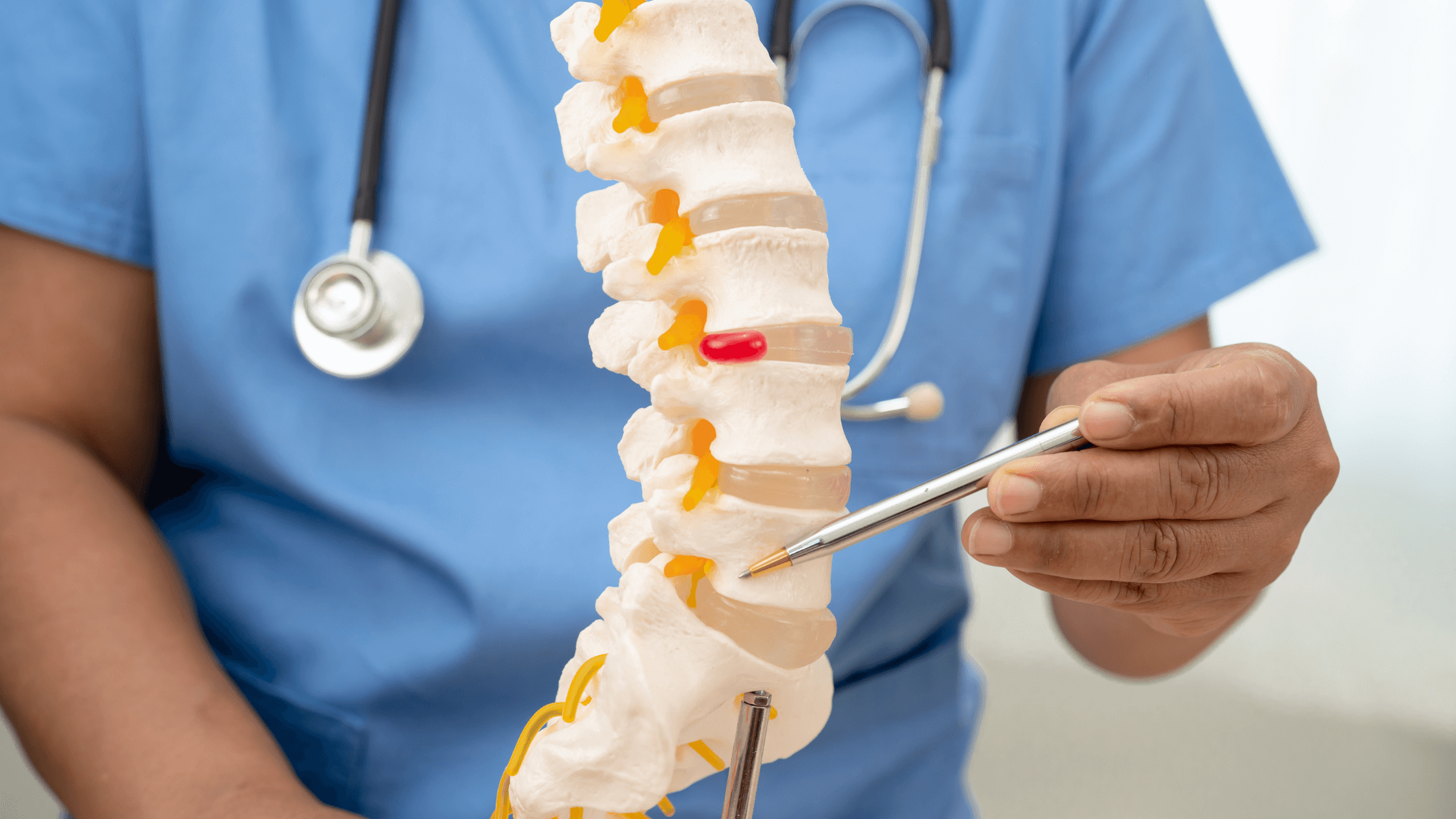 A doctor in blue scrubs uses a pointer on an anatomical model of the lumbar spine, demonstrating a herniated disc pressing on the sciatic nerve root to a patient, illustrating the cause of recurring sciatica pain.