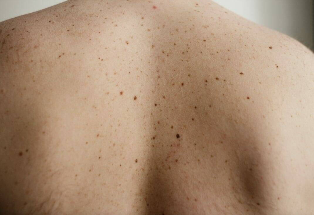 Private Dermatology Clinic In Reigate 1.Jpg