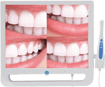 RIXI Medical intraoral camera