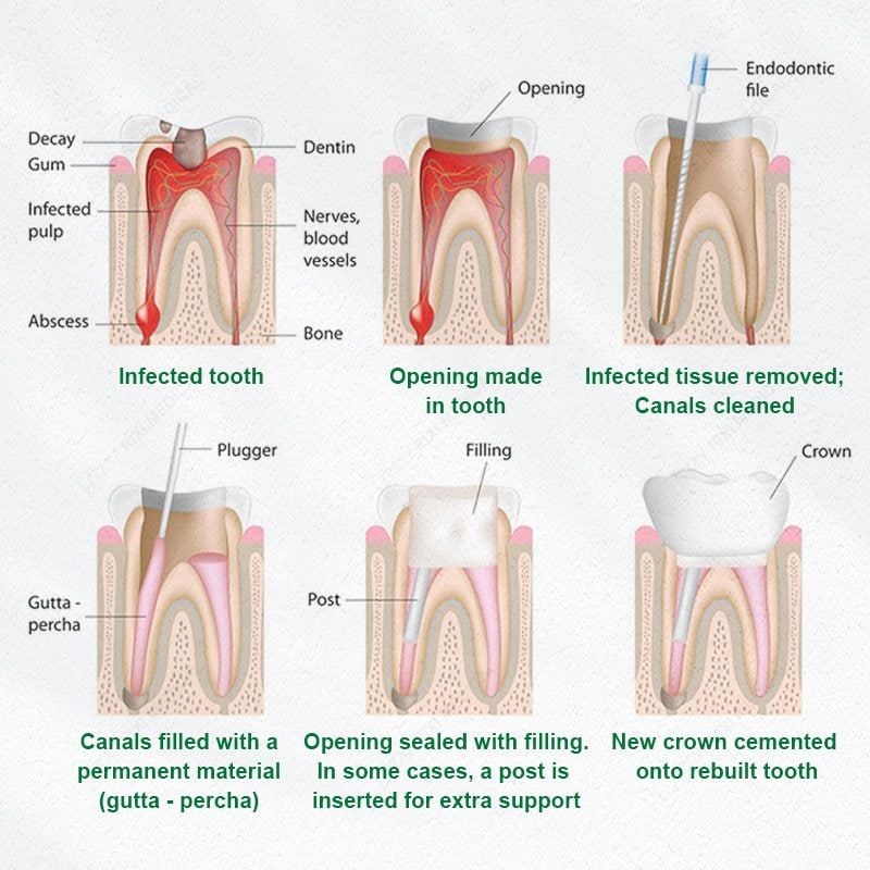 RIXI Medical professional dental equipment