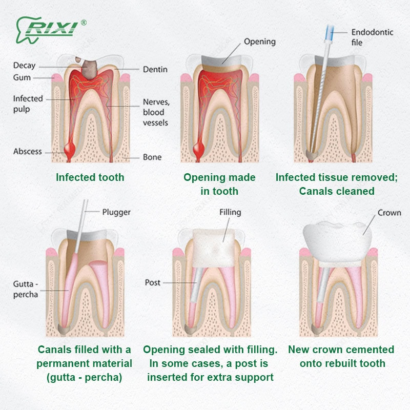 Best Dental Chair Brands — CE/FDA Certified by Rixi Medical
