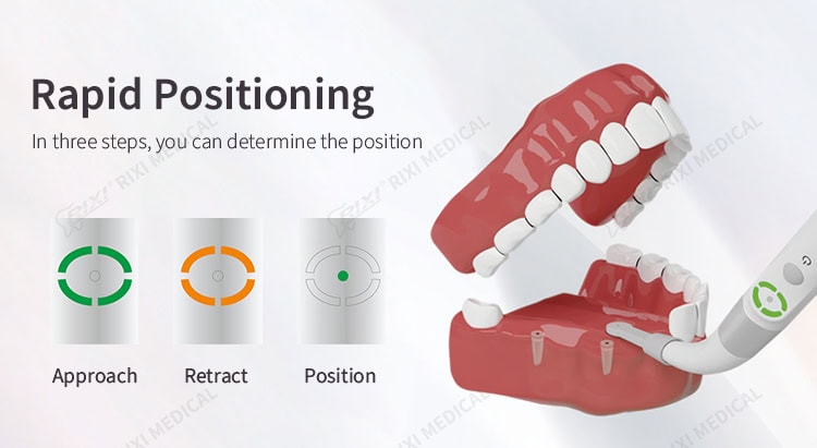 dental implant locator detail image 2