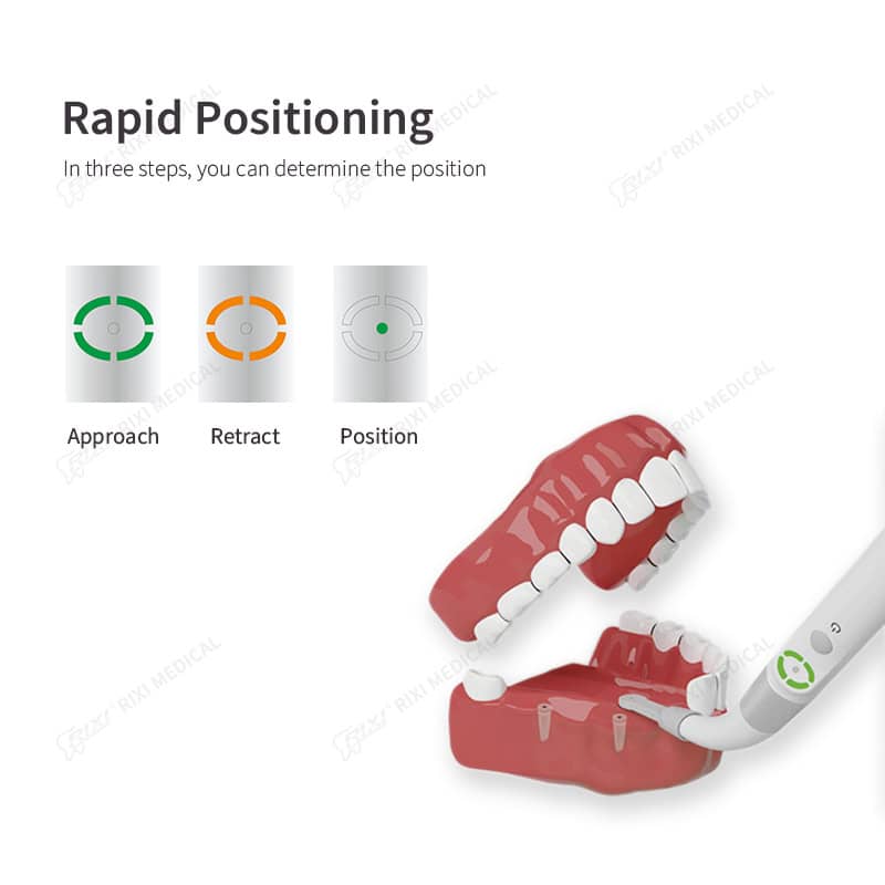 Dental Implant Locator for Precise Implant Positioning main image 4