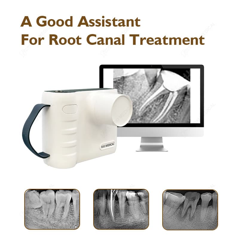 handheld dental x ray machine main image 18