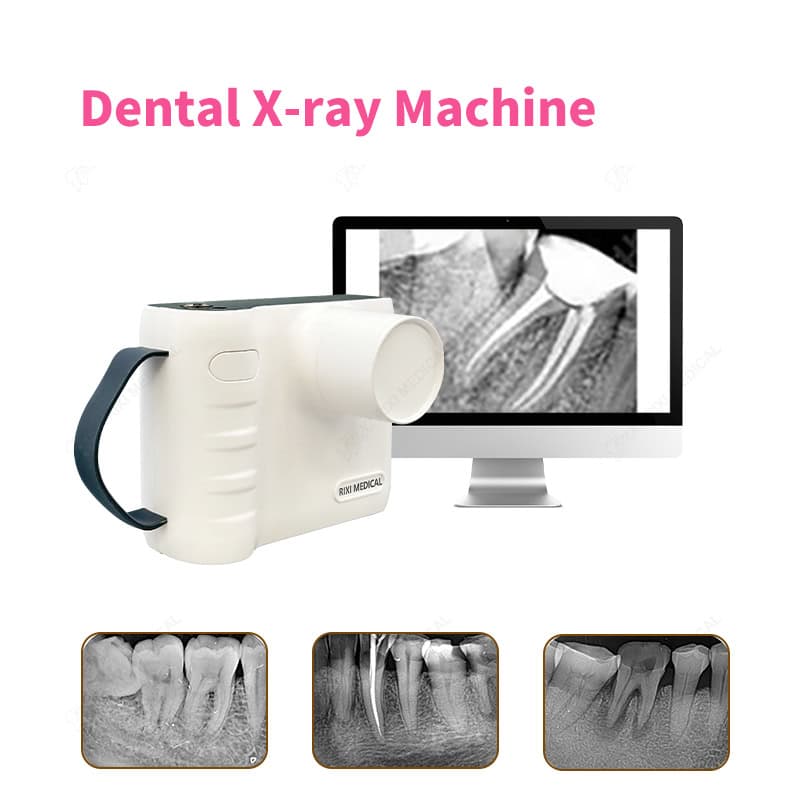 handheld dental x ray machine main image 28