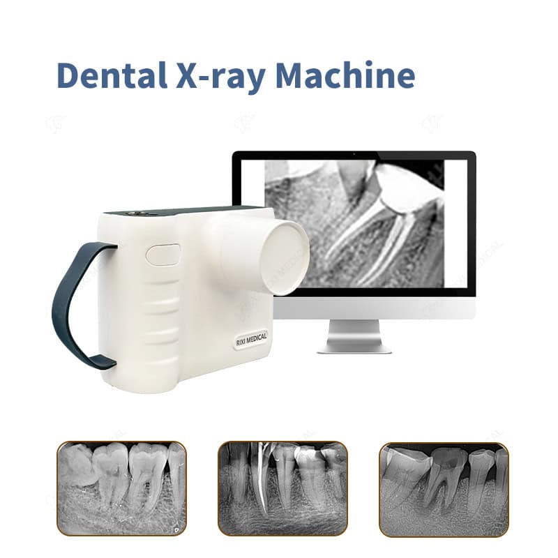 handheld dental x ray machine main image 29