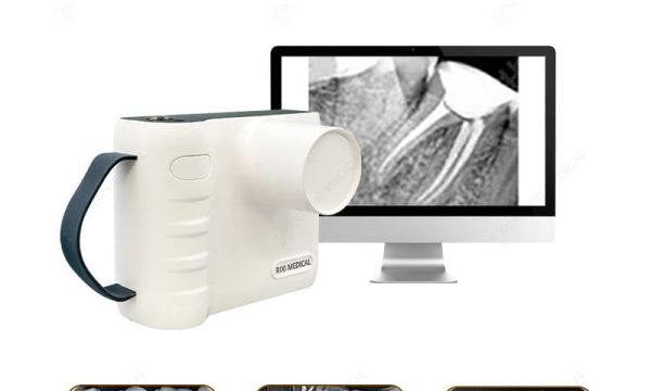 handheld dental x ray machine main image 1