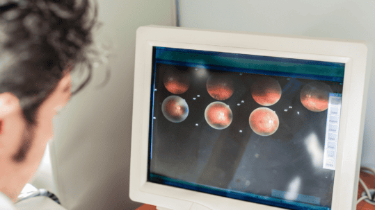 Eye doctor reviewing retinal images on a monitor to check for diabetic macular edema in Billings, MT