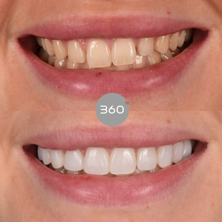 Before and after close-up: 