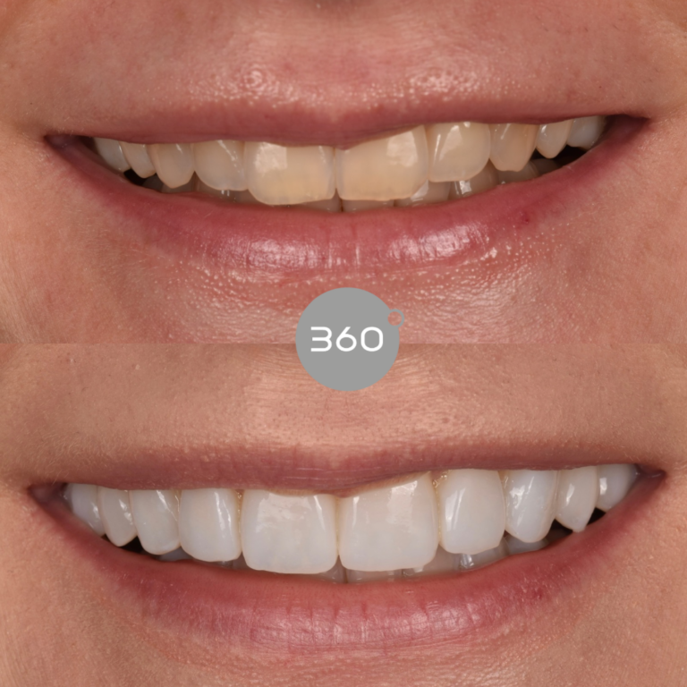 Before and after close-up: 