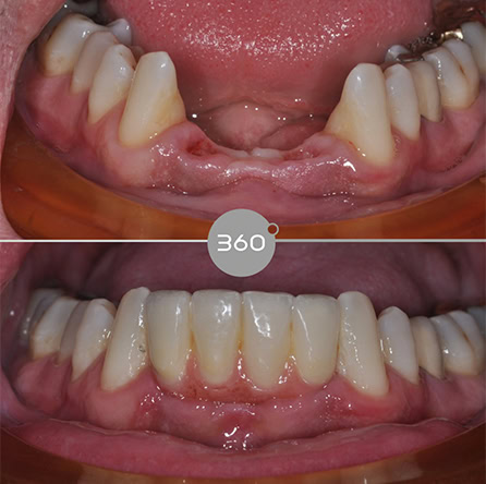 Before and after close-up: 