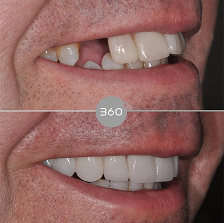 Before and after close-up: 