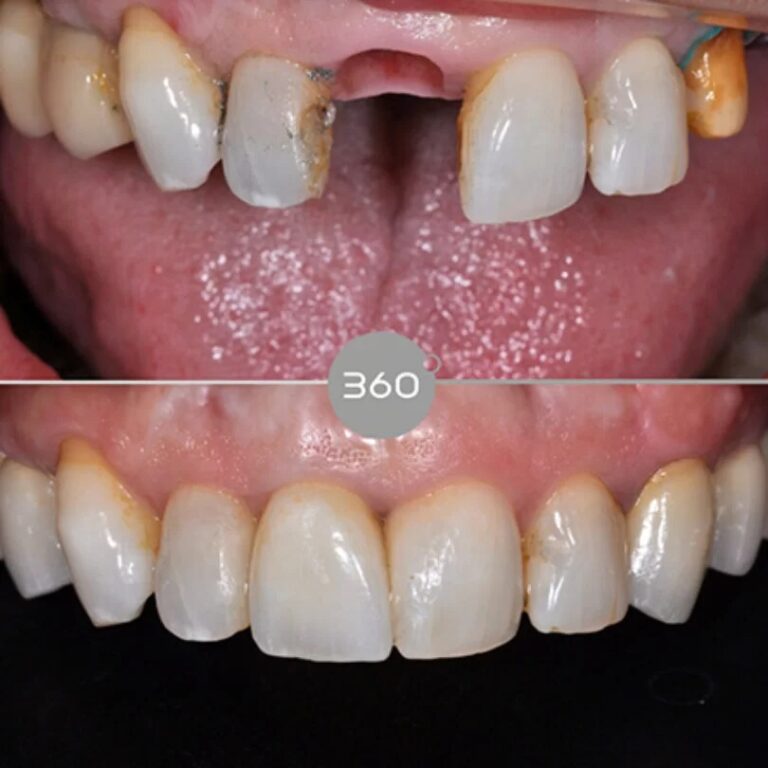 Before and after close-up: 
