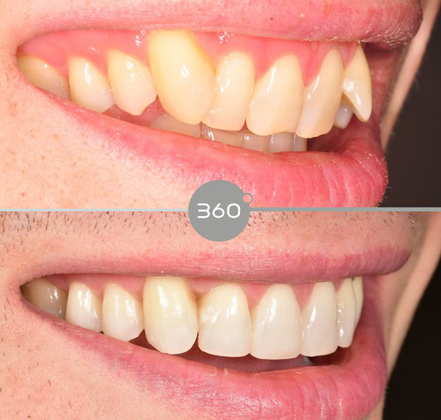 Before and after close-up: 