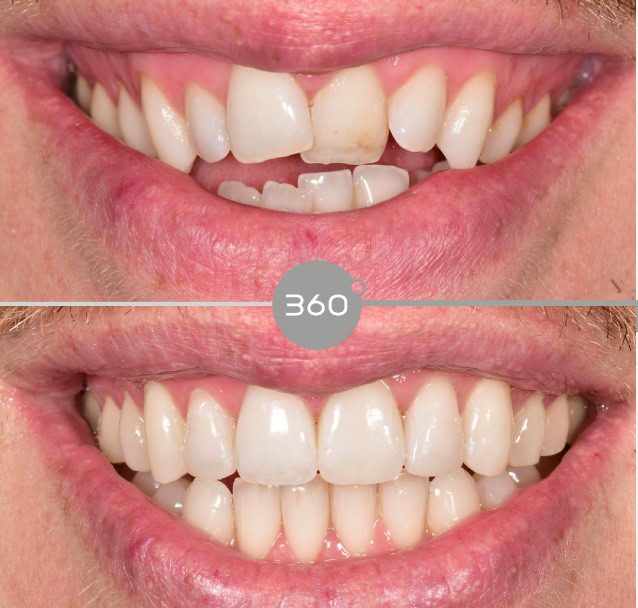 Before and after close-up: 