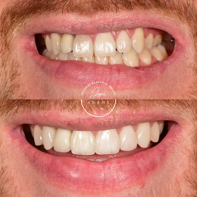 Before and after close-up: 