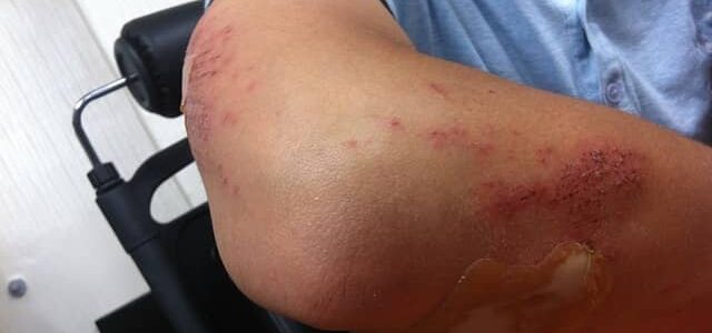 ¿Las comunidades de propietarios deben cumplir la normativa de Prevención de Riesgos Laborales? ¿Las comunidades de propietarios deben cumplir la normativa de Prevención de Riesgos Laborales?