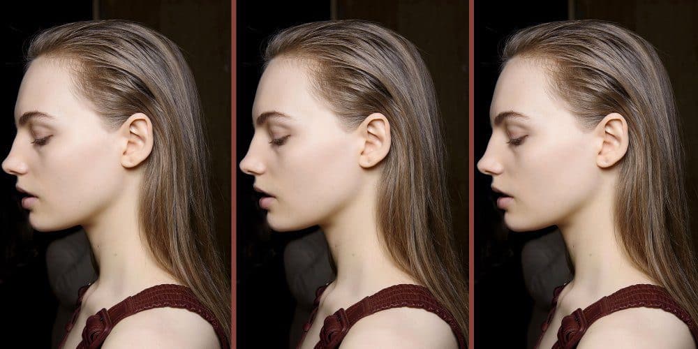 combattre les cheveux gras naturellement