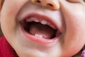 Supporting Growing Smiles: Essential Tips for Children’s Oral Health in Brisbane