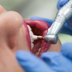 brisbane cbd dentist
