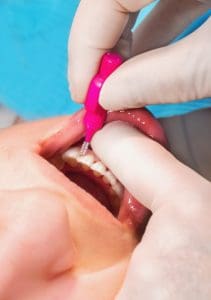 brisbane cbd dentist