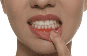 brisbane city dentist 