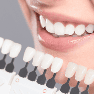 teeth whitening brisbane cbd 