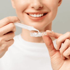Tooth whitening Brisbane