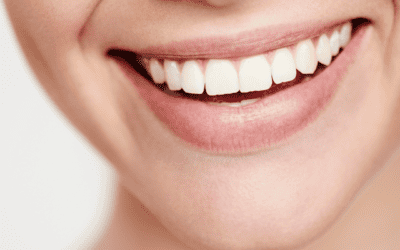 Replacing Missing Teeth in Brisbane CBD – Options to Restore Your Smile