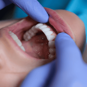 patient with white teeth and nice smile while seeing brisbane cosmetic dentist