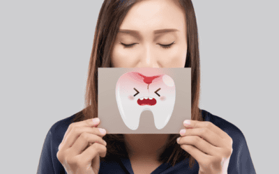 Why Teeth Crack (and How to Reduce the Risk)