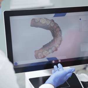 Digital scans as part of dental implant planning
