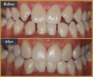 cosmetic dentist brisbane