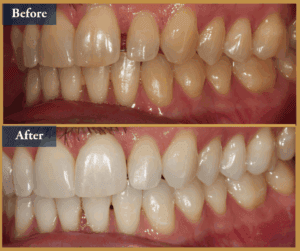 Cosmetic Dentist Brisbane