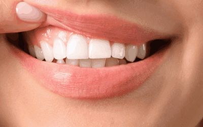 Why Healthy Gums Matter