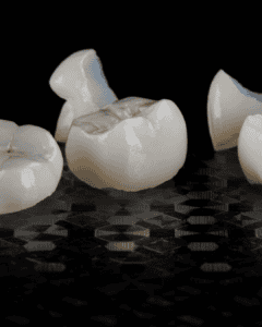 Dental crowns Brisbane CBD