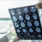 Brain MRI scan, medical imaging, healthcare, neurology, doctor examining brain scan, medical diagnosis, radiology, neurological health, medical professional at work, neuroscience research.