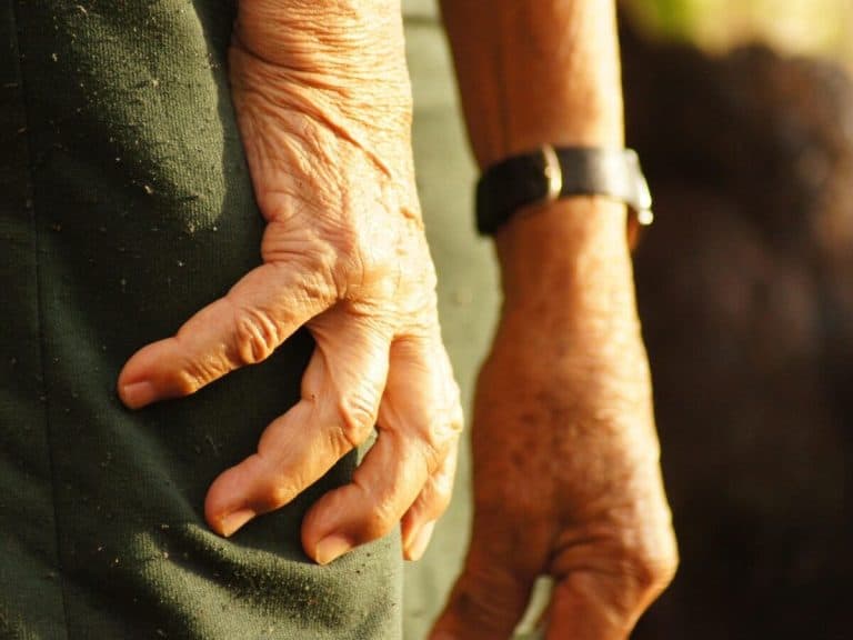 Working hands that are dry and cracked.