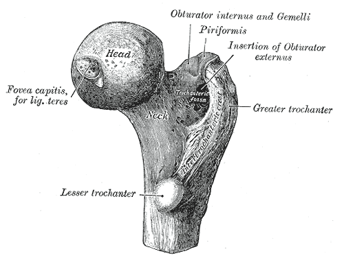Femur Fracture Settlement Values Florida Personal Injury cases
