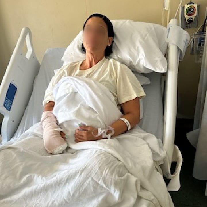 woman in hospital bed with cast on arm, and IV in her other arm