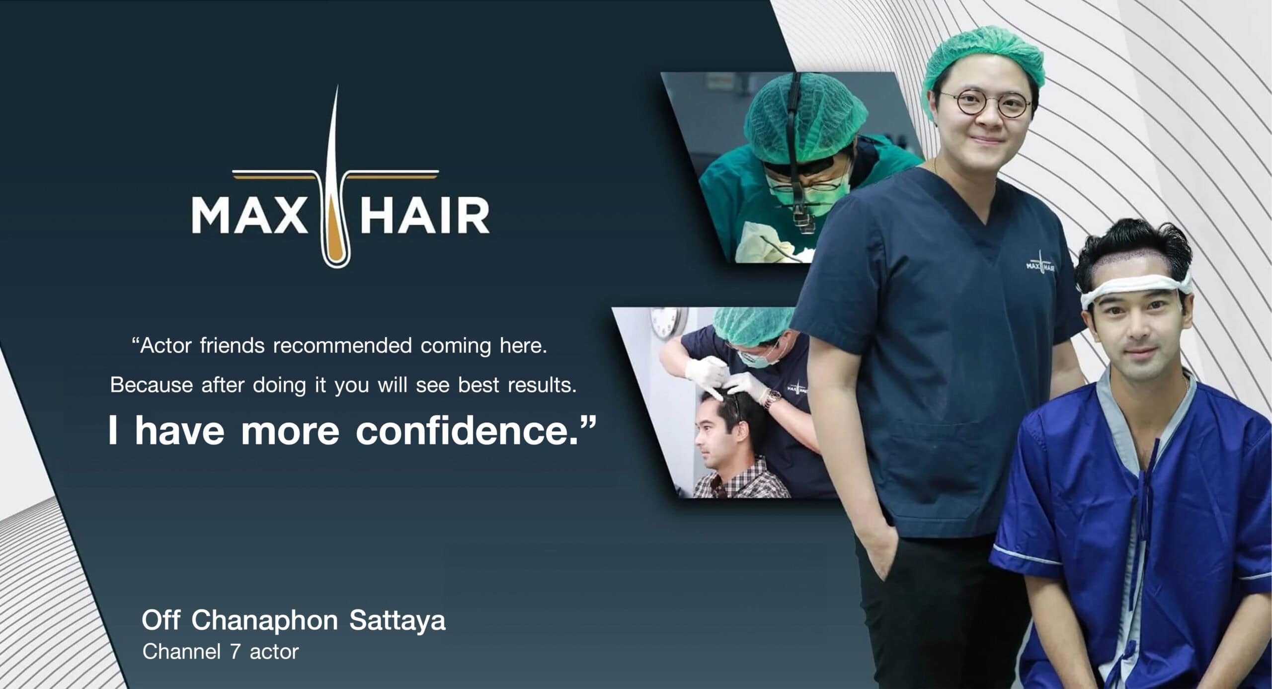 Testimonial for Max Hair Thailand from Off Chanaphon Sattaya