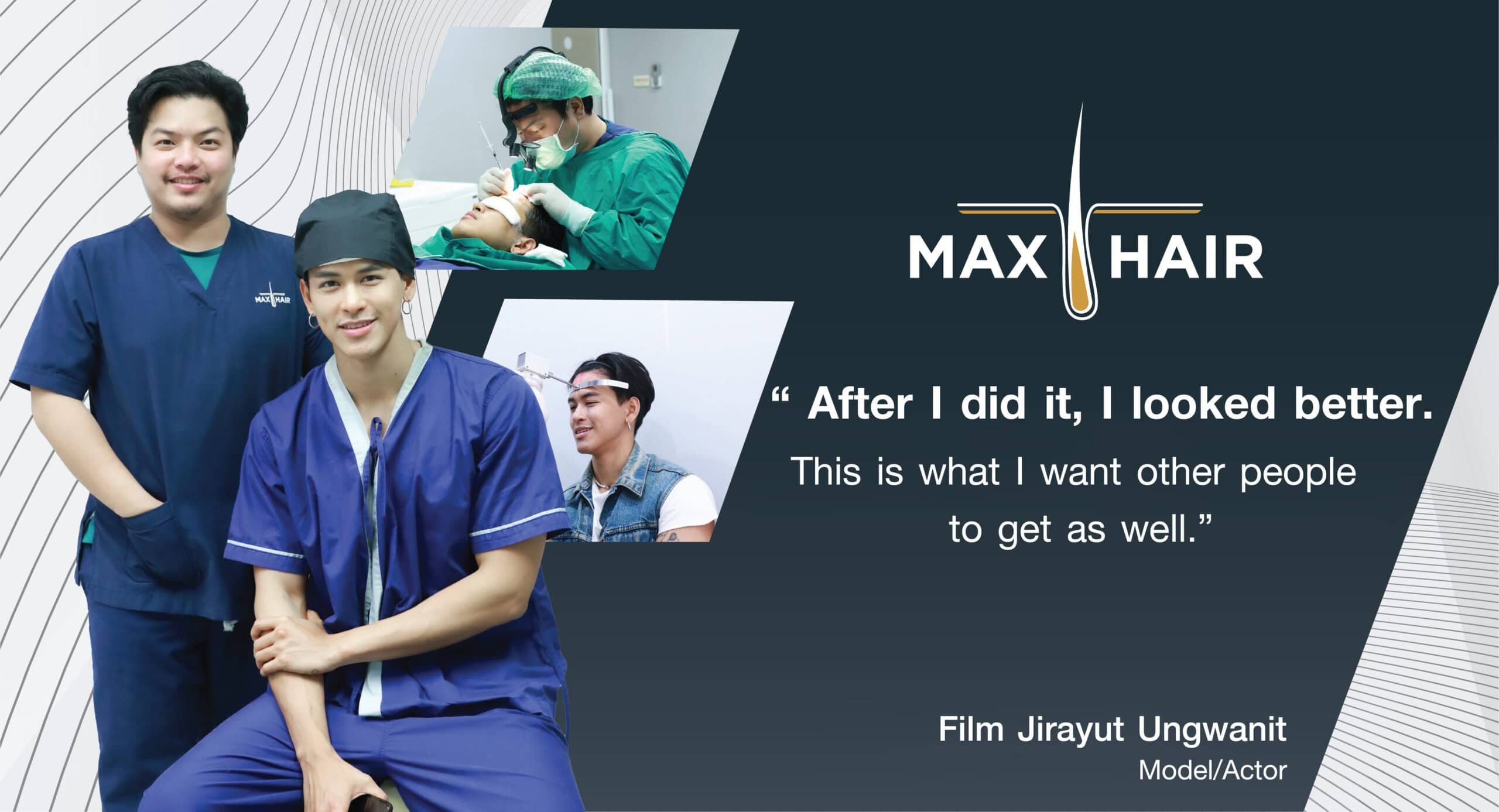 Testimonial for Max Hair Thailand from Film Jirayut Ungwanit